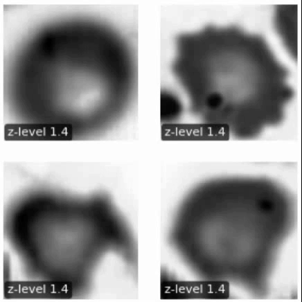 Guided Augmentation MICCAI